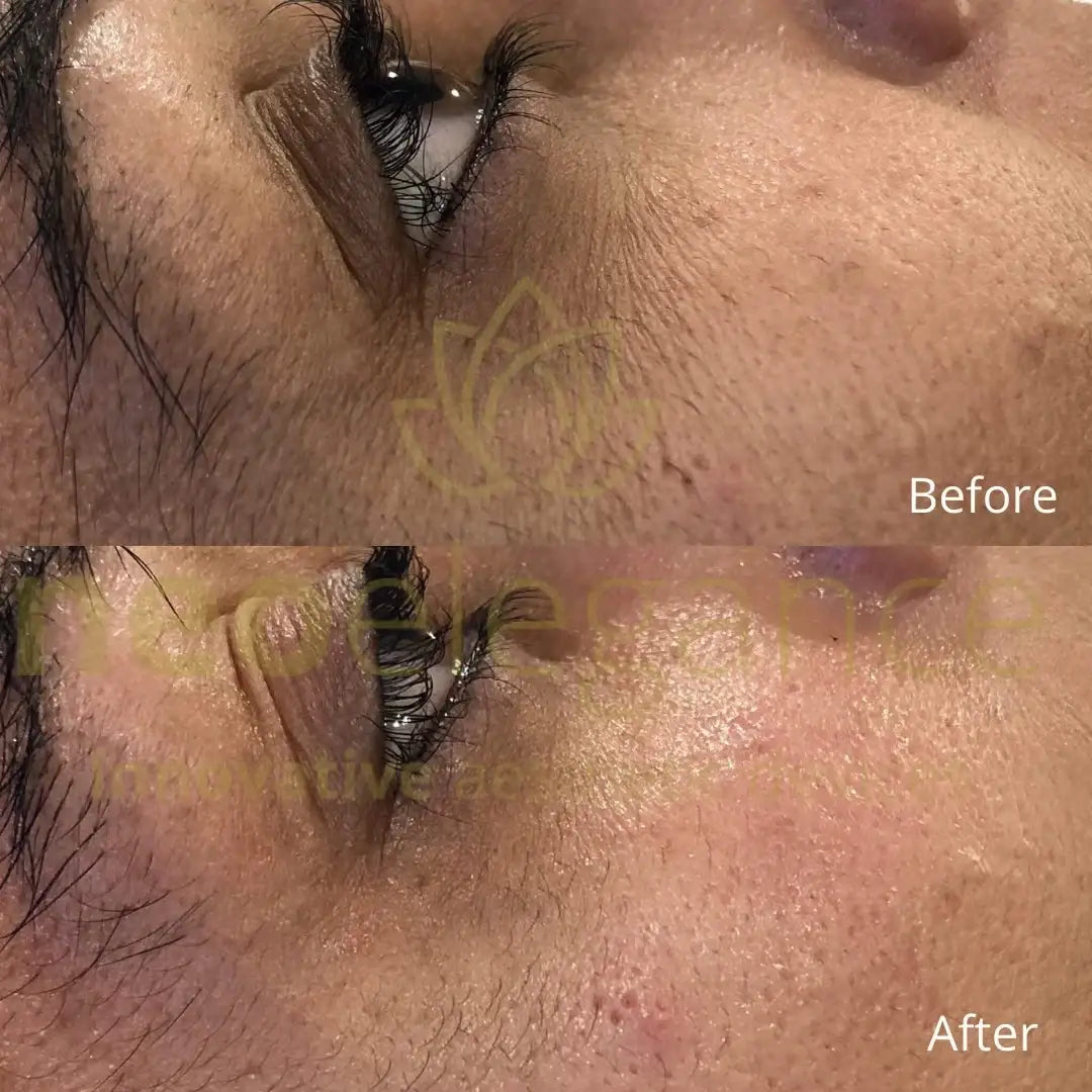 LumiPro Advanced Facial Toning Device - Neo Elegance Ltd