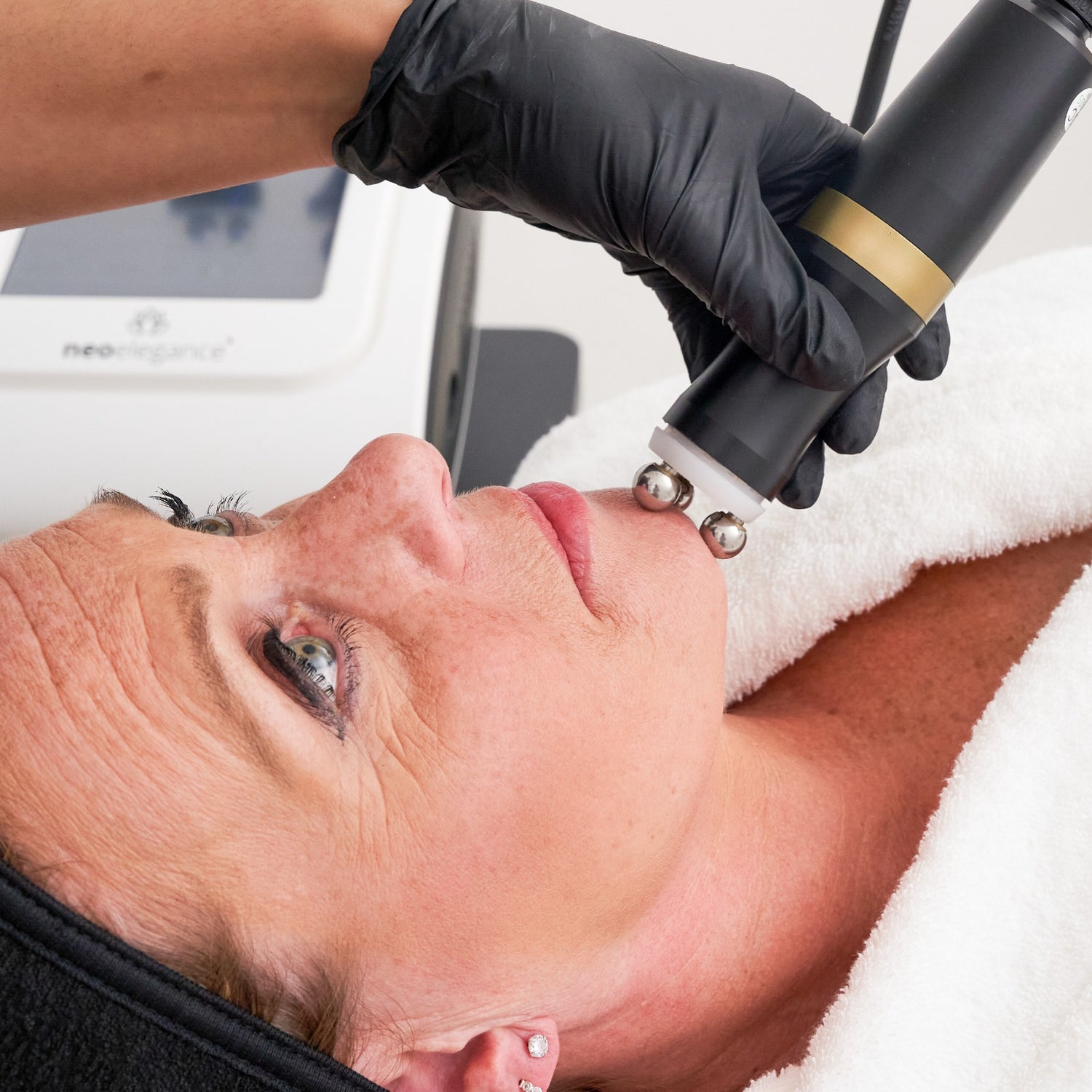 radiofrequency used in the face, to tone facial muscles